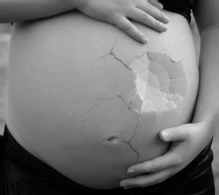 Signs And Symptoms You Just Had a Miscarriage